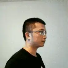  脖子后的富贵包会夺命真相还是谣言