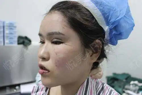  姐妹们下午好小新人一枚,来跟大家分享一下我的整...眼部多项悦美整形