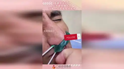 蜜蜡脱毛的人,应该都是勇士吧,没有一个是享受的表情