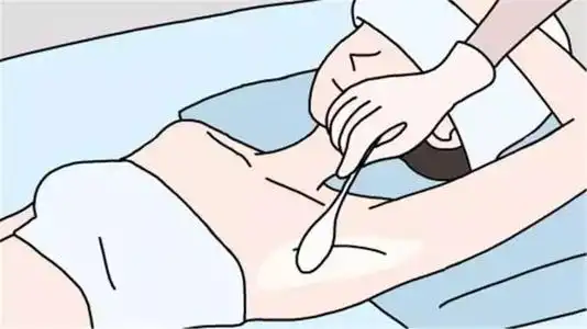  打完肉毒素之后出现高低眉怎么办面部紧绷如何解决