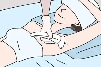  杭州激光脱毛注意事项