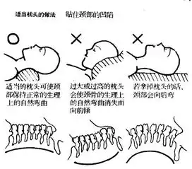  除了久坐之外,这六种坐姿也会引起颈椎病