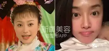  金星老师医美讲堂范爷好点,可李冰冰这眼角