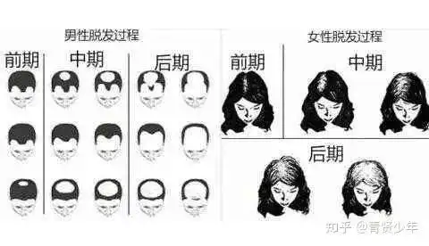  自救脱发两个月,这是我给你们画的重点