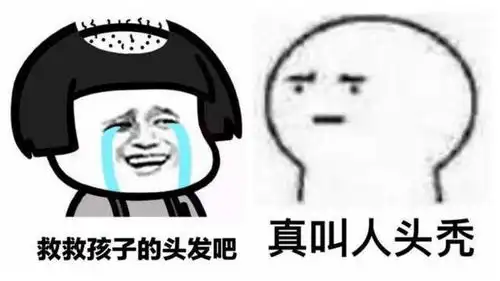  别让头秃成为烦恼,快看看这个发际线守护者