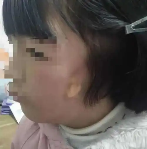  qing听丨种耳朵的孩子