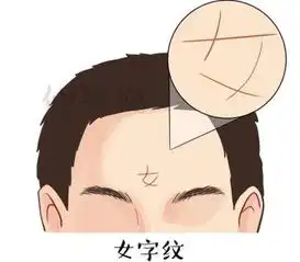  富贵象征的额头纹路